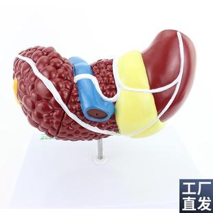 ENOVO颐诺人体肝胆疾病模型肝胆内科H普外科肝胆系统病理展示医生