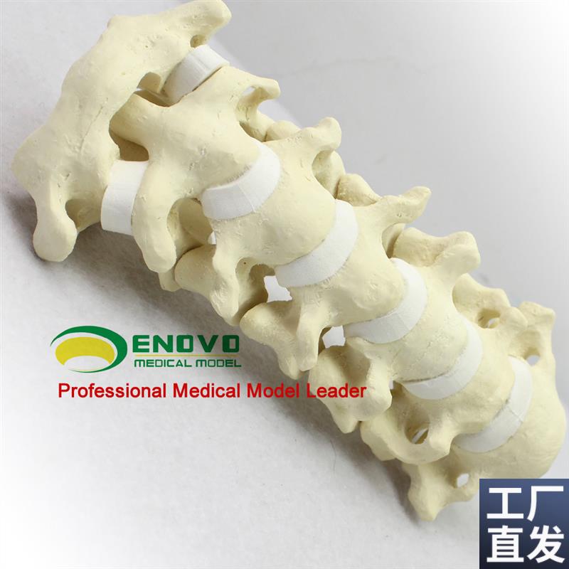 ENOVO颐诺骨科仿真人体颈椎模D型医学骨科手术仿真骨颈椎前路后