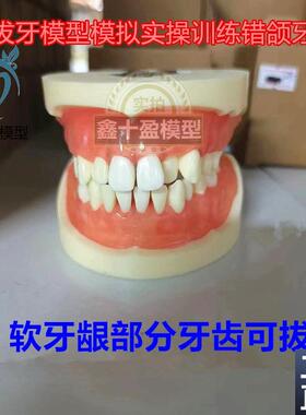 牙科8016拔牙练习模型s软牙龈树脂牙齿医患沟通练习带牙根错颌模