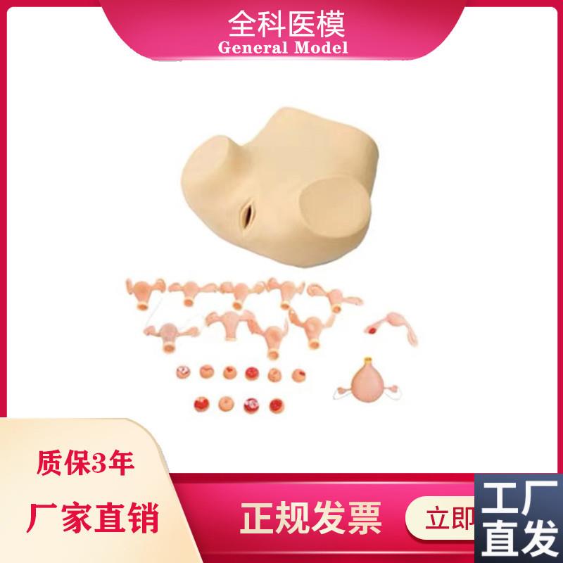 妇科检查训e练模型脓肿积水宫颈炎白斑息肉女性生殖器护理人模型