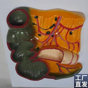 人体阑尾盲肠解m剖模型肠解剖模型人体模型医用教学