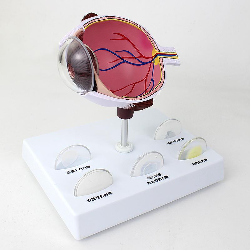 ENOVO颐诺人体眼球白内障眼疾病瞳孔眼球体眼珠晶体医学教具白内