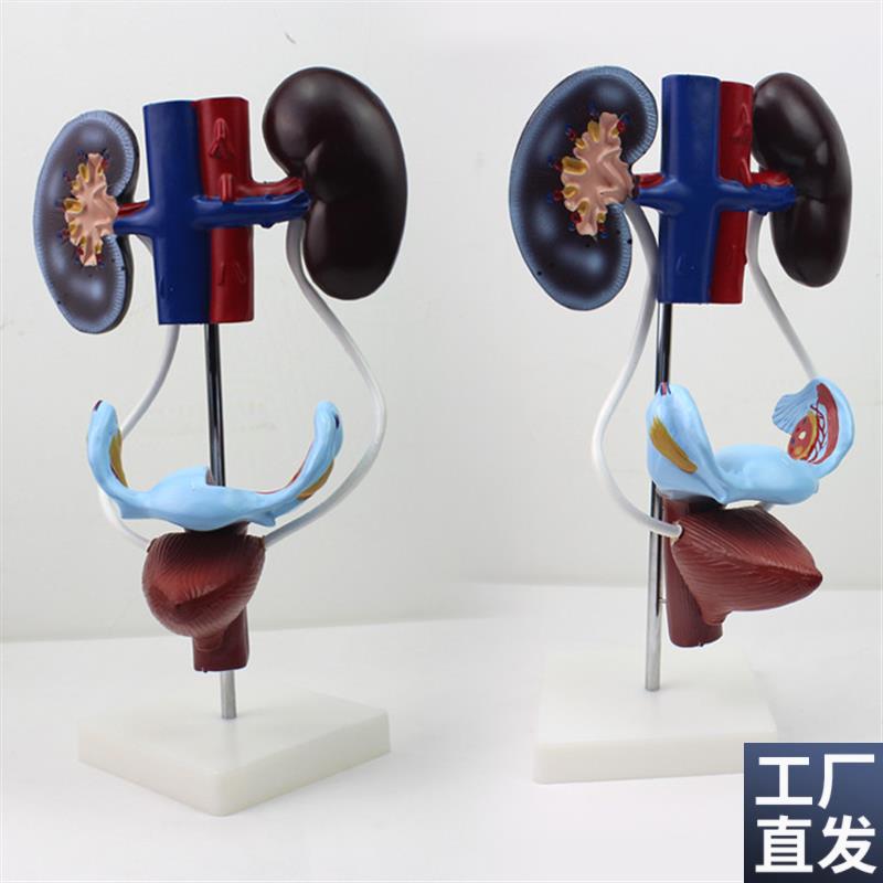 颐诺正品医用女性泌尿生殖系统模型生殖解剖Q肾脏子宫膀胱模型