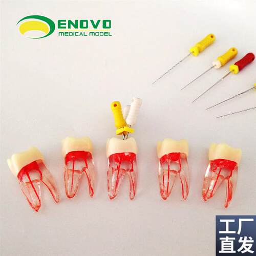 ENOVO颐诺根管l仿真离体RCT根管教学练习牙体牙髓根管器械操作