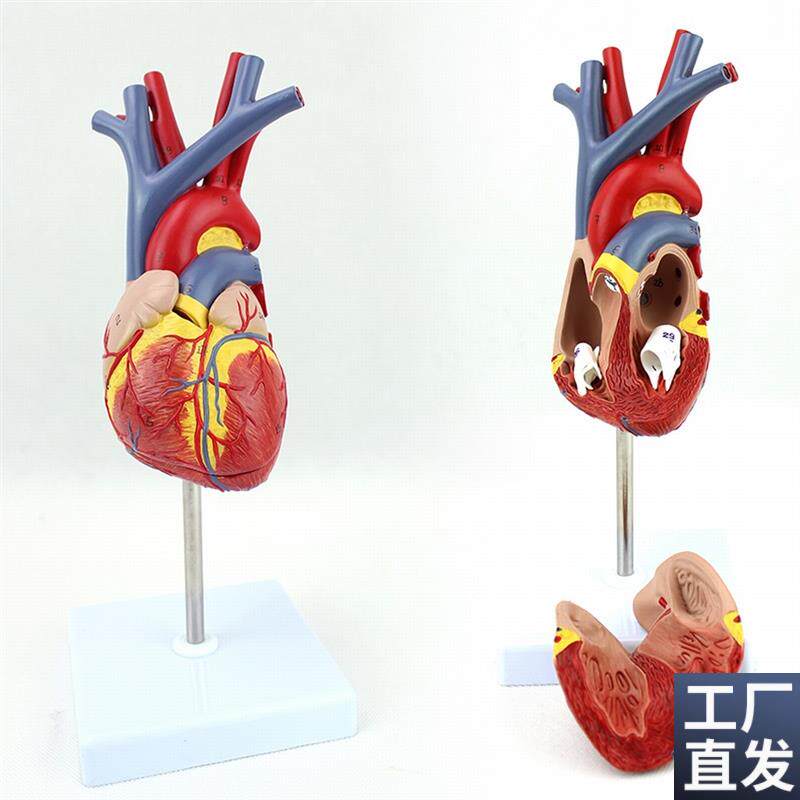 ENOVO颐诺人k体心脏模型医学心血管内科心脏介入解剖教学冠状动脉