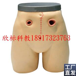高级瘘管造口术护理模型造瘘术护理模型I回肠造瘘模型结肠造口模