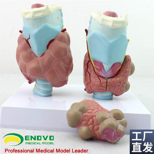 ENOVO正品人体甲状腺病w理模型甲亢甲低甲减内分泌系统医学解剖