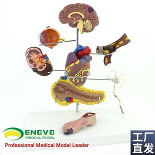 ENOVO颐诺人体医学糖尿病模型并发症大脑心O脏胰腺神经元足内外科
