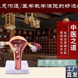 人体子宫解剖h模型子宫模型子宫癌变输卵管狭窄综合疾病科普教育