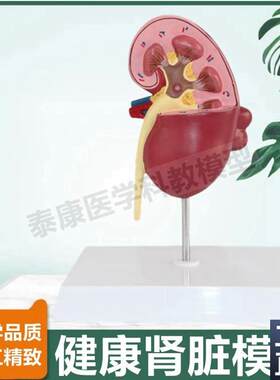 人体肾脏结构模型泌尿器官肾小球肾单位蛋K白尿形成功能受损医患