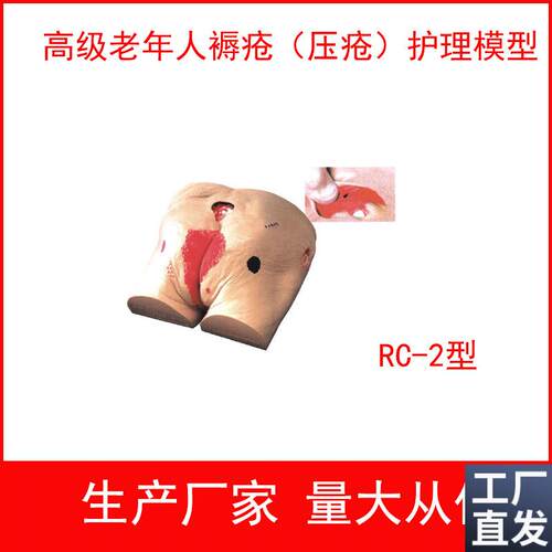 高级老年人褥疮(压p疮)护理模型老年人褥疮护理压疮护理模型