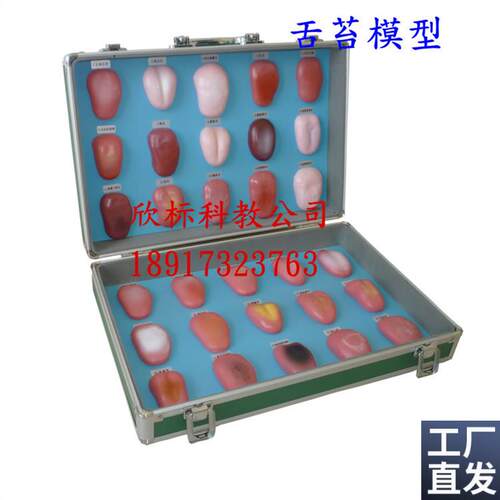 舌苔模型舌像模型30种s正常舌苔及各种疾病在舌苔上的病态变症状