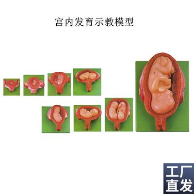 宫内发育示教模型