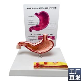 人体胃部消化系统解剖模型v内脏解剖胃炎教学医学教具厂家直销