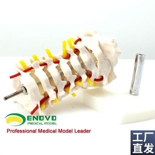 ENOVO颐诺人体颈椎颈动脉模型颈椎模型寰N枢关节人体骨骼标本模