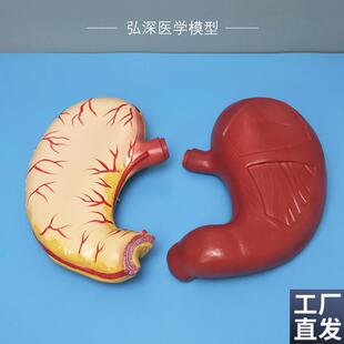 人体胃解剖模型2倍放大胃u壁胃肠道消化系统中学生物医学教学道具