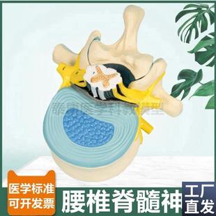 腰椎脊髓解剖模型脊神经根椎管临床麻G醉教学神经节周围椎间盘人