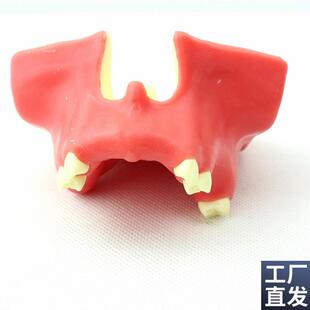 ENOVO颐诺牙医口腔即刻种植培训上颌骨上颌窦底T提升术操作模型口