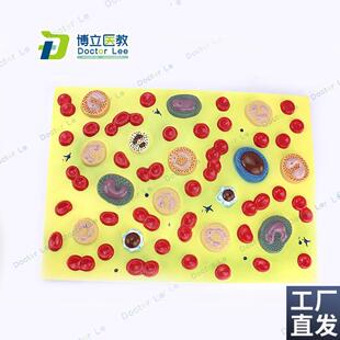 医学人体血细胞放大模型x血液病学内科病理生理教学模型