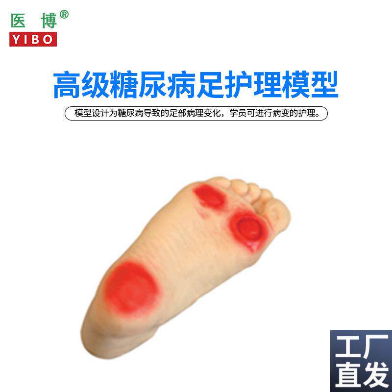 医博BIX-HS19糖尿病足护理模型足部病理展示X示教模型教具