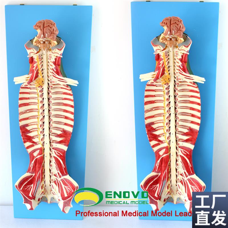 ENOVO颐诺医学人体脊柱椎管A解剖脊髓神经麻醉脊腰椎微创骨科模型