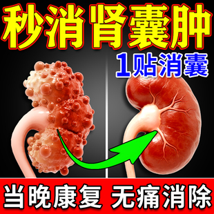 肾囊肿特效膏药苗昶堂治疗腰腹疼痛肿块尿血蛋白尿专用中成穴位贴