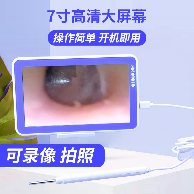 可视挖耳勺耳镜高清耳鼻喉内窥镜检测仪掏耳朵神器采耳仪采耳工具