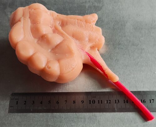 外科腹腔镜阑尾切除3D模型模块