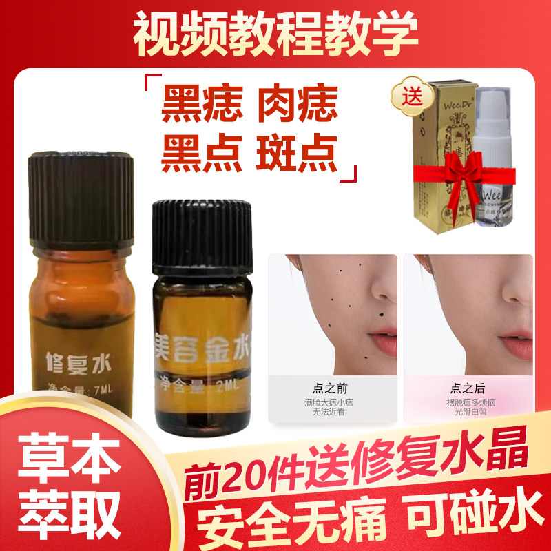 美容金水取脸部痣美容院专用仪器笔点斑水去雀斑水点痦子无痕正品