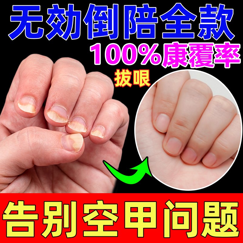甲床修复生长液指甲受损萎缩甲肉分离空甲断裂竖纹护甲油甲床增长