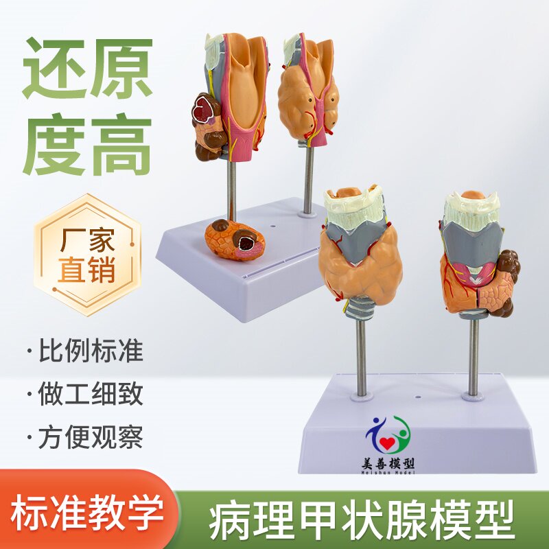 美善模型病理甲状腺模型