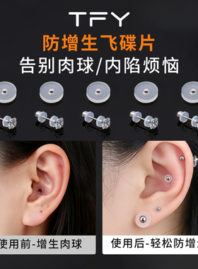 防增生小飞碟耳钉后塞耳堵硅胶养耳洞防内陷软垫片耳骨钉耳蜗钉