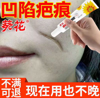 【葵花】凹陷性疤痕专用祛疤膏