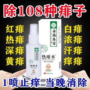 痱子药膏去痱子止痒热痱祛痱止痒根去儿童成人炉甘石湿疹外用喷剂