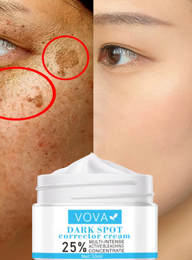 3pcs Effective Whitening Freckle Cream Remove Melasma Acne