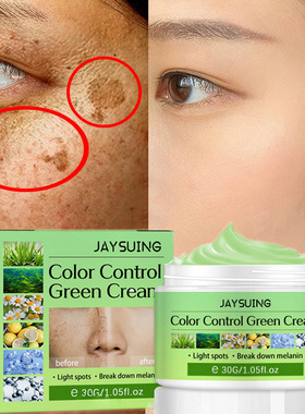 Whitening Freckles Cream Remove Melasma Dark Spot Lightening