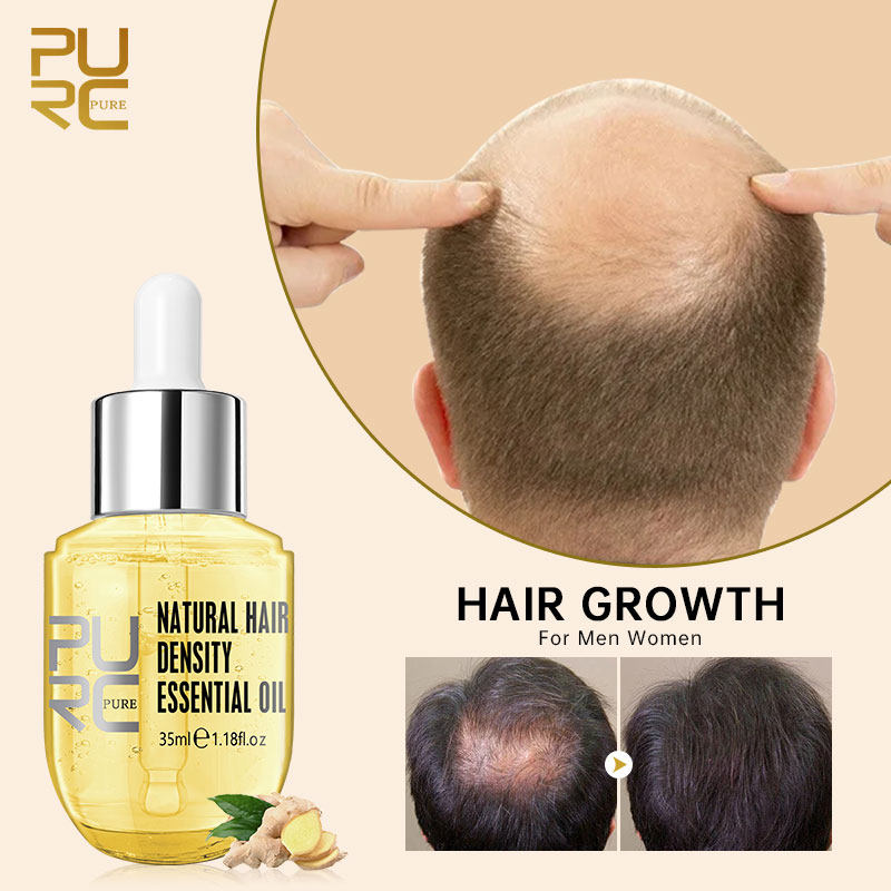 ginger essentials hair growth sprays products for men women