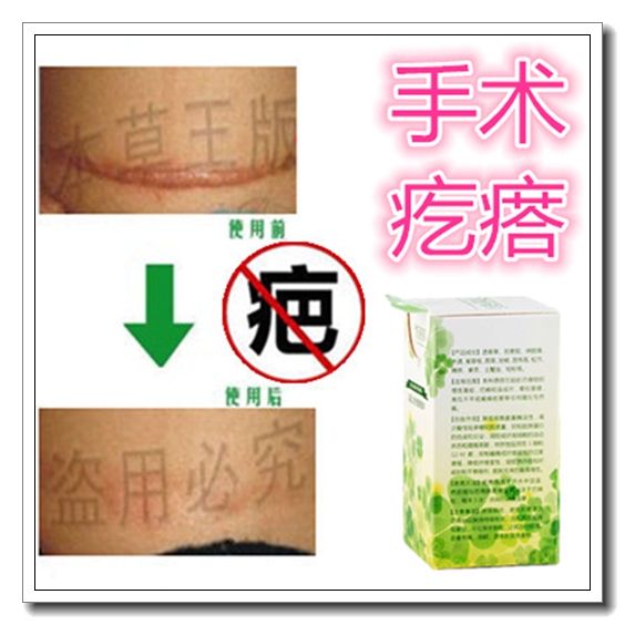 反黑修复去脸部烫烧伤疤痕药膏祛陈旧老疤膏淡化刨腹产黑色素沉淀