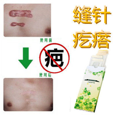 除去腿上疙瘩祛手术增生性凸疤剖腹产伤疤痕印灵修复缝针抓痕乳液