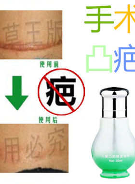 祛男女手术缝针淡化增生性凹凸疙瘩消除去产后开刀伤疤痕印修复液