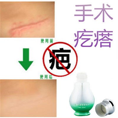 灵增生修复疙瘩性突起缝针开眼角刀伤巴痕激光手术抓伤摔伤撞伤疤
