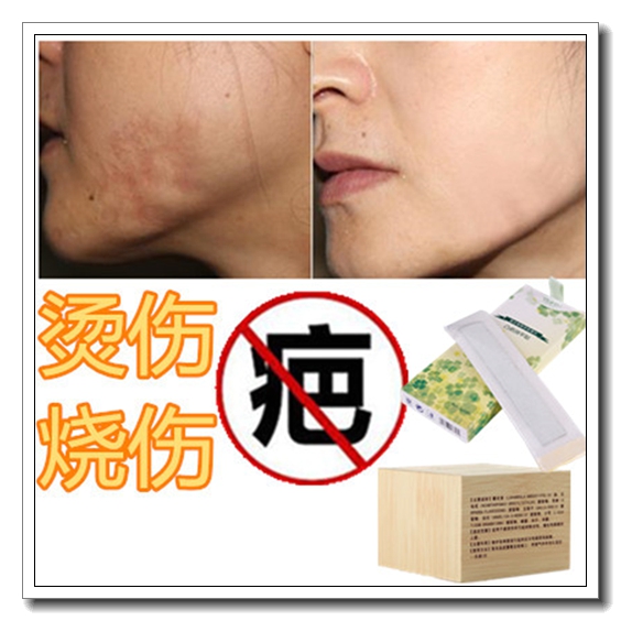 祛增生烧烫伤疤痕灵疙瘩凝胶去除凸起疤克星防色素修复液硅酮敷料