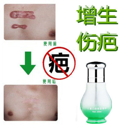 修复祛凸起开刀伤疤痕印消除去增生性冻疮疙瘩手术产后摔伤药乳液