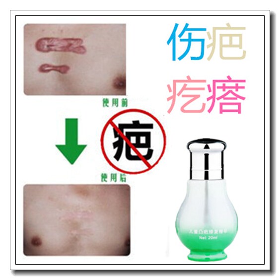 祛脸上部刀伤疤痕印修复手术凸起增生性贴嘴部去黑色素泰国除巴膏