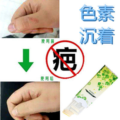 淡化去暗沉红印痘疤痕印修护抓伤色素印痕祛除黑色素沉淀回流产品
