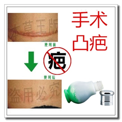 去除手术伤口愈合贴修复摔伤疤痕灵药膏消祛冻疮凸起疙瘩红印凝胶