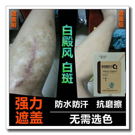 白殿风外用药持久修复白斑净精华霜消除膏白颠疯遮盖液白点疯遮瑕