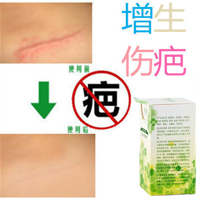 去手术修复增生性突起疙瘩破腹产刀伤巴痕烟疤缝针抓伤摔伤双眼皮