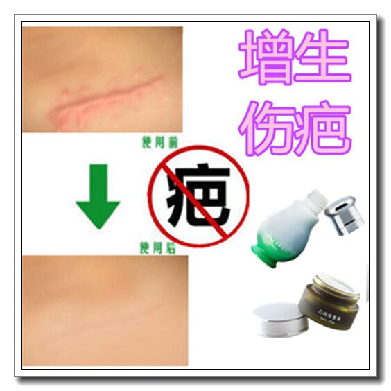 修复剖腹产伤疤痕膏消针缝疤祛白印去除膝盖黑色素肤蜡烟疤遮盖贴