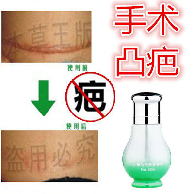 灵增生修复疙瘩性突起手术增生性刀伤巴痕纹身缝针抓伤摔伤撞伤疤